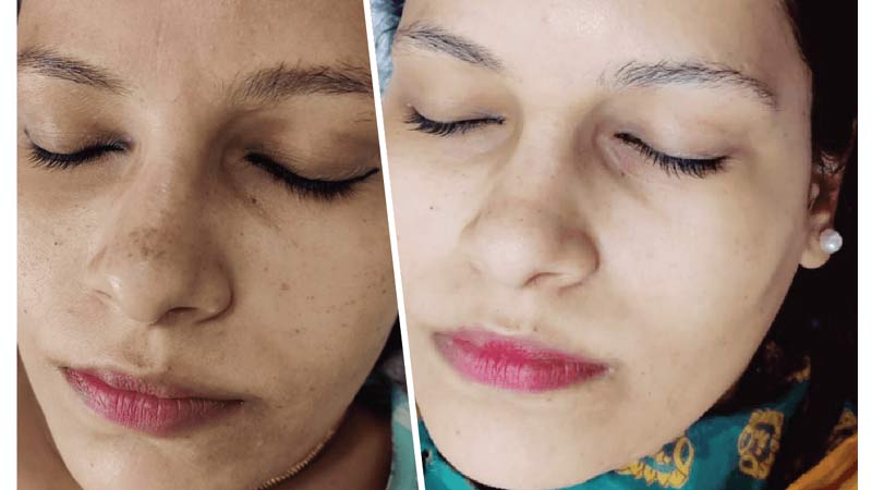 Glow & Clean Urgent Whitening Facial