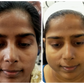 DERMA ONE GOLD SKIN POLISH