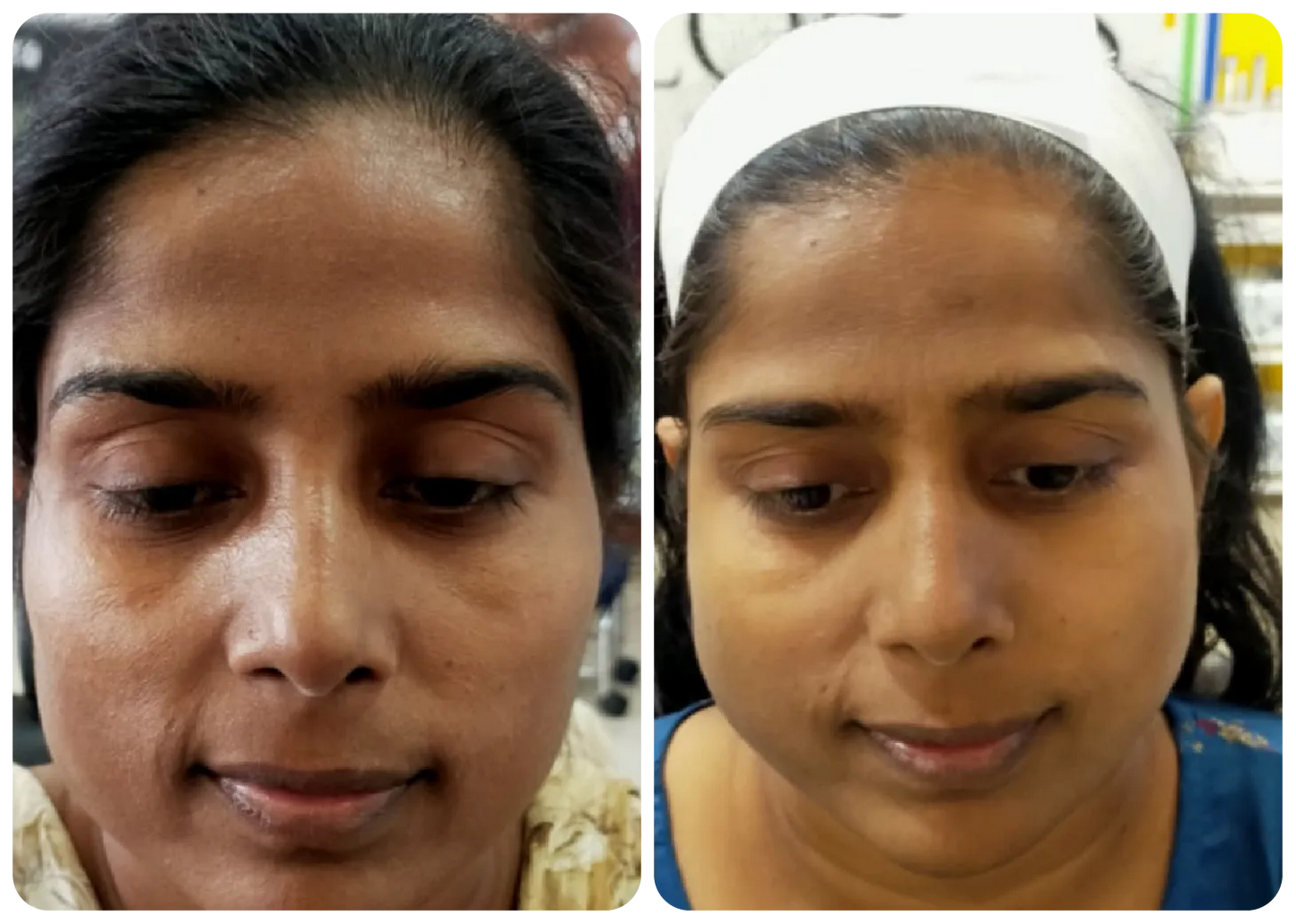 DERMA ONE GOLD SKIN POLISH